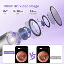 GAOMON Ear Wax Removal EV1 with 1080P HD Ear Camera Ear Cleaner