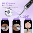 GAOMON Ear Wax Removal EV1 with 1080P HD Ear Camera Ear Cleaner