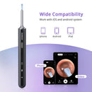 GAOMON Ear Wax Removal EV1 with 1080P HD Ear Camera Ear Cleaner